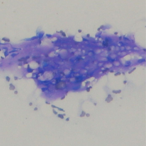 貓注射部位惡性肉瘤 Feline Injection Site Sarcoma (FISS或稱VAS)