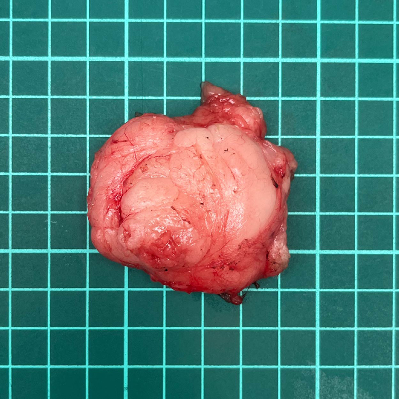 6歲比熊犬切除之脂肪瘤團塊