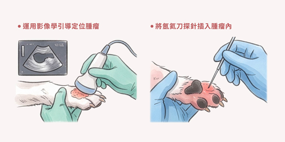 氬氦刀 / 冷凍消融治療-治療進行方式