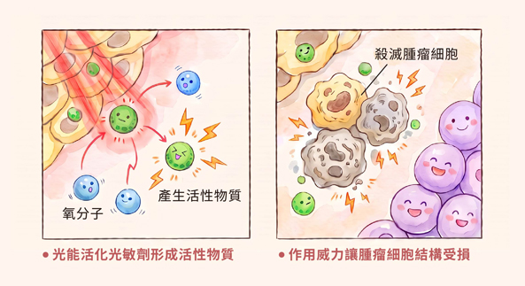 光動力治療 (PDT) 原理介紹