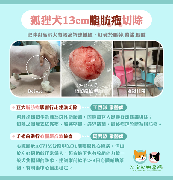脂肪瘤的治療案例說明